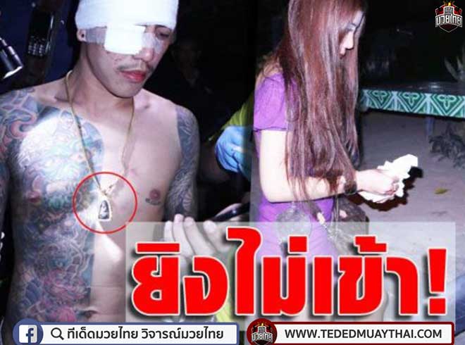 มือปืน ประกบยิงพี่นักมวยดัง กระสุนเข้าหัว-หน้าอก รอดปาฏิหาริย์ มีแค่รอยไหม้ 